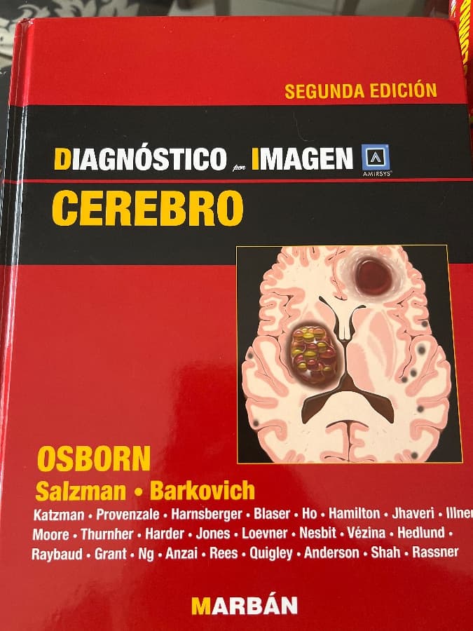 Diagnóstico por Imagen: Cerebro (Segunda Edición)