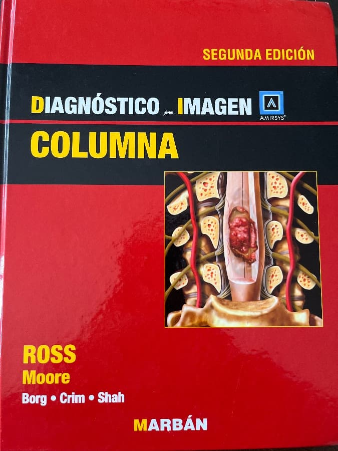 Diagnóstico por Imagen: Columna (Segunda Edición)